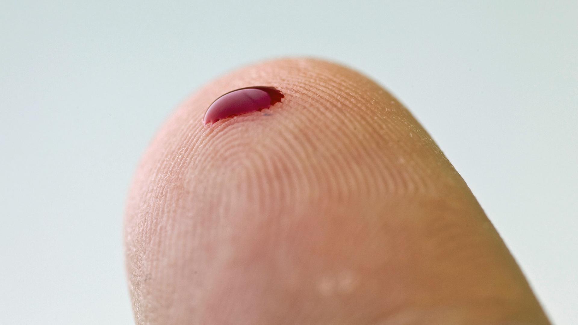 Ein kleiner Blutstropfen auf einem Finger. Mithilfe eines solchen Tropfens und eines Messgerätes können zum Beispiel an Diabetes erkrankte Menschen den Zuckergehalt des Blutes bestimmen. Ein kleiner Blutstropfen auf einem Finger. Mithilfe eines solchen Tropfens und eines Messgerätes können zum Beispiel an Diabetes erkrankte Menschen den Zuckergehalt des Blutes bestimmen.