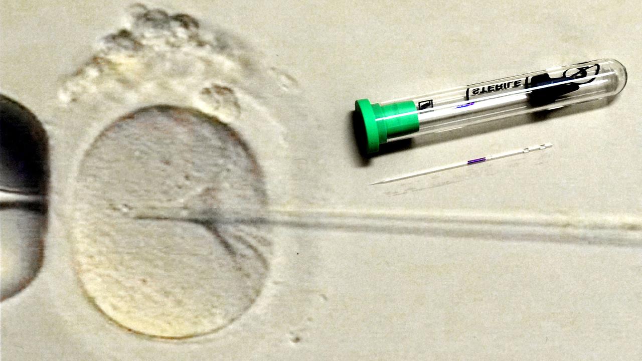 Im Biologischen Labor des Zentrums für Reproduktionsmedizin an der Universitätsfrauenklinik in Leipzig ist eine 200-fache Vergrößerungen der Befruchtung einer Eizelle zu sehen, aufgenommen am 17.03.2011. Im Biologischen Labor des Zentrums für Reproduktionsmedizin an der Universitätsfrauenklinik in Leipzig ist eine 200-fache Vergrößerungen der Befruchtung einer Eizelle zu sehen, aufgenommen am 17.03.2011.