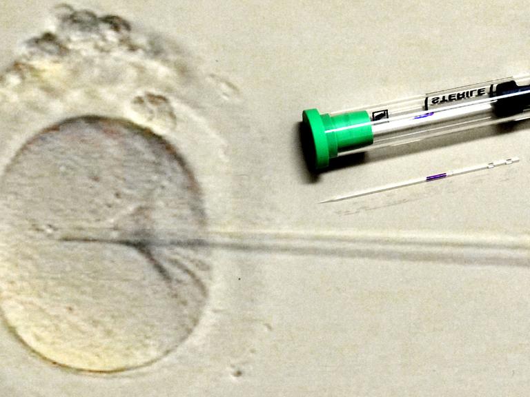 Im Biologischen Labor des Zentrums für Reproduktionsmedizin an der Universitätsfrauenklinik in Leipzig ist eine 200-fache Vergrößerungen der Befruchtung einer Eizelle zu sehen, aufgenommen am 17.03.2011.