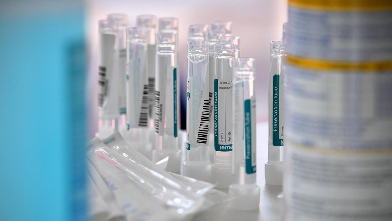 Röhrchen mit den Abstrichen von Personen, die sich in einem Corona-Testzentrum einem PCR-Test unterzogen haben Röhrchen mit den Abstrichen von Personen, die sich in einem Corona-Testzentrum einem PCR-Test unterzogen haben