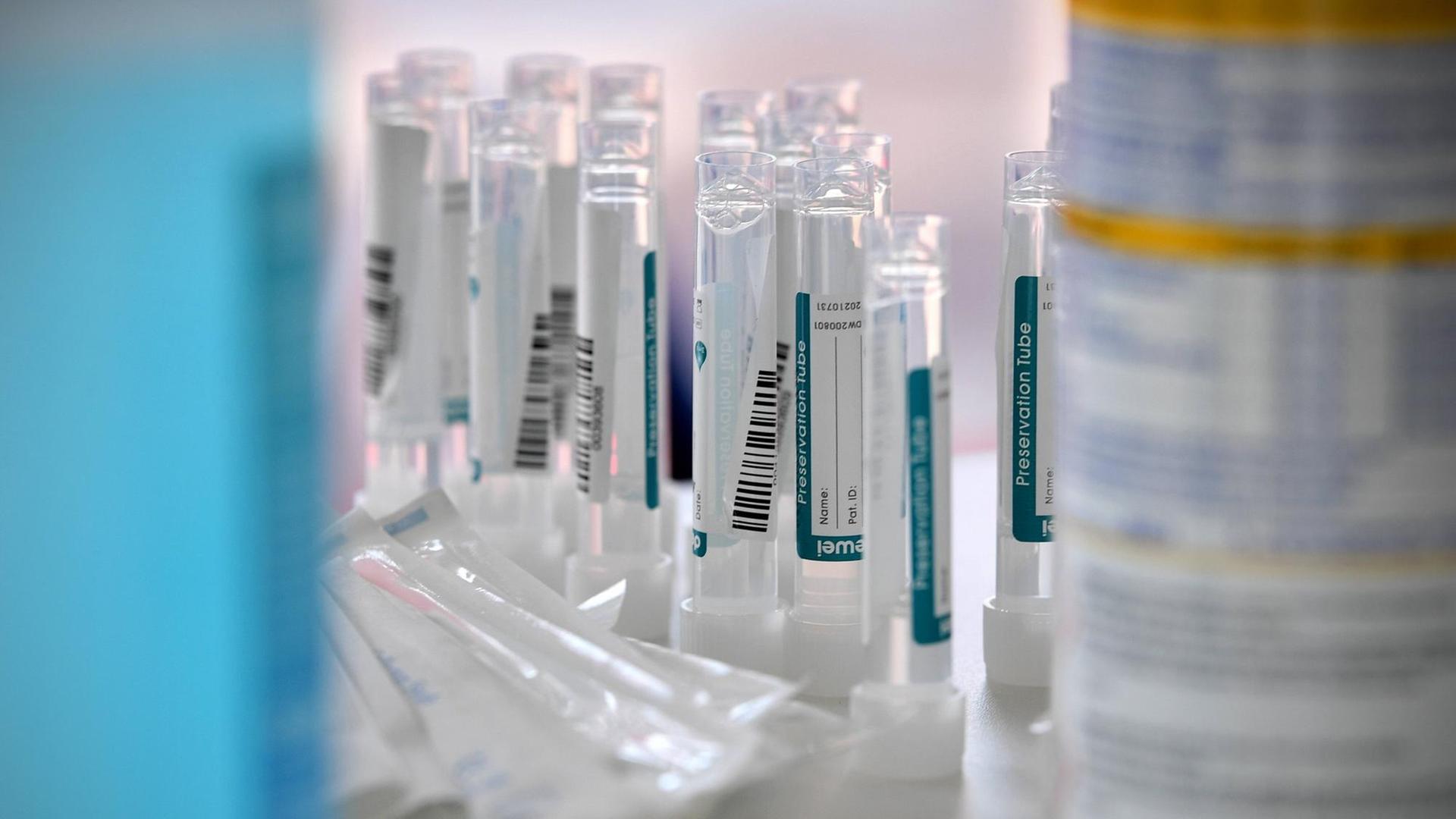 Röhrchen mit den Abstrichen von Personen, die sich in einem Corona-Testzentrum einem PCR-Test unterzogen haben