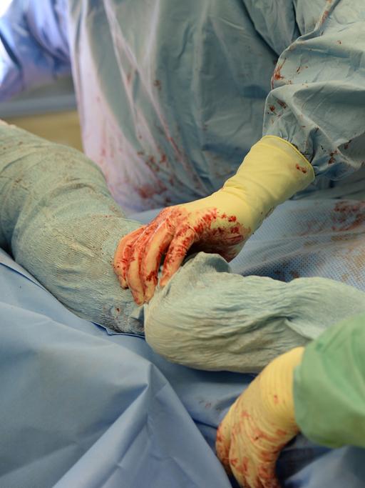 Ein Mediziner-Team operiert in einer Klinik in Baden-Württemberg eine Hüfte.