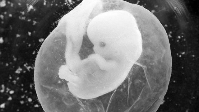 Das Foto zeigt einen sieben Wochen alten Fötus in einer Fruchtblase.