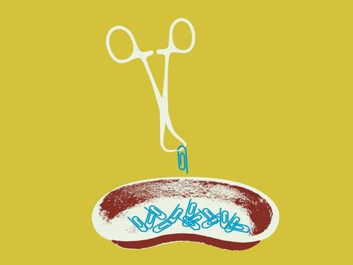 Illustration vor gelbem Hintergrund: Chirurgische Pinzette hebt Büroklammern aus einer Nierenschale.