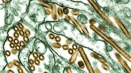 Ein neuer Impfstoff soll vor dem Virus H5N1 schützen. Ein neuer Impfstoff soll vor dem Virus H5N1 schützen.