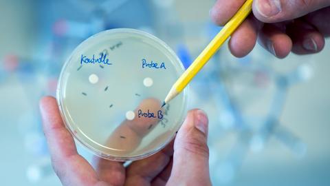 Ein Mann zeigt auf eine Petrischale mit unterschiedlichen Antibiotikaproben.