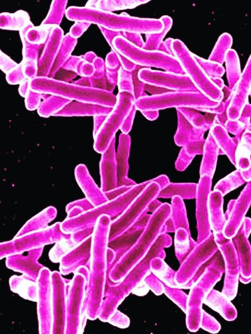 Mikroskopische Aufnahme eines rosa fadenartigen Mykobakteriums