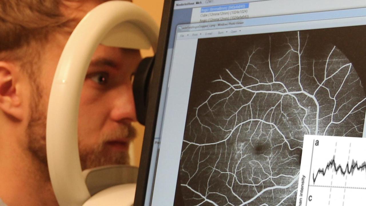Ein Mann am Augenscanner, der mit Hilfe von Lasern Augenkrankheiten erkennen könnte Ein Mann am Augenscanner, der mit Hilfe von Lasern Augenkrankheiten erkennen könnte