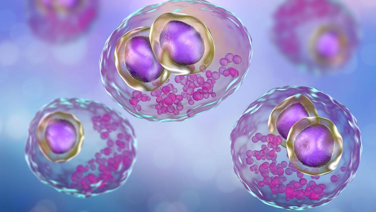 Cytomegalovirus-InfeKtion. (Computer-Illustration) Cytomegalovirus-InfeKtion. (Computer-Illustration)