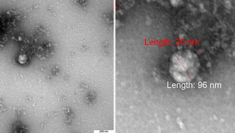 Auf zwei grauen ,parallelmontierten Bildern sind graue Klumpen ,einer mit einer Breite von 96mm beschrieben Darum herum : diffuser grauer Nebel Auf zwei grauen ,parallelmontierten Bildern sind graue Klumpen ,einer mit einer Breite von 96mm beschrieben Darum herum : diffuser grauer Nebel