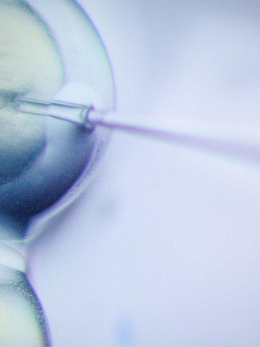 Ein Schritt des CRISPR/Cas9-Verfahrens ist in einem Labor am Max-Delbrück-Centrum für Molekulare Medizin in vielfacher Vergrößerung auf einem Monitor zu sehen.
