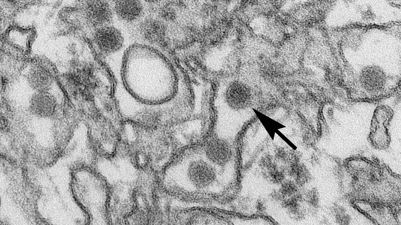 Zika-Virus unter dem Elektronenmikroskop. Es gehört zur Familie der Vlaviviridae. Die Virus-Partikel betragen 40 nm in Diameter mit einer äußeren Hülle und dem inneren Kern. Der Pfeil zeigt einen einzelnen Virus-Partikel. Das Zika-Virus wird durch Mückenstiche übertragen. Die bekanntesten Symptome sind Fieber, Ausschlag, Gelenkschmerzen und Bindehautentzündung (gerötete Augen). Das Virus steht im Verdacht, für Missbildungen bei Kindern verantwortlich zu sein.Foto: Cynthia Goldsmith / Center for Disease Control and Prevention/dpa Zika-Virus unter dem Elektronenmikroskop. Es gehört zur Familie der Vlaviviridae. Die Virus-Partikel betragen 40 nm in Diameter mit einer äußeren Hülle und dem inneren Kern. Der Pfeil zeigt einen einzelnen Virus-Partikel. Das Zika-Virus wird durch Mückenstiche übertragen. Die bekanntesten Symptome sind Fieber, Ausschlag, Gelenkschmerzen und Bindehautentzündung (gerötete Augen). Das Virus steht im Verdacht, für Missbildungen bei Kindern verantwortlich zu sein.Foto: Cynthia Goldsmith / Center for Disease Control and Prevention/dpa
