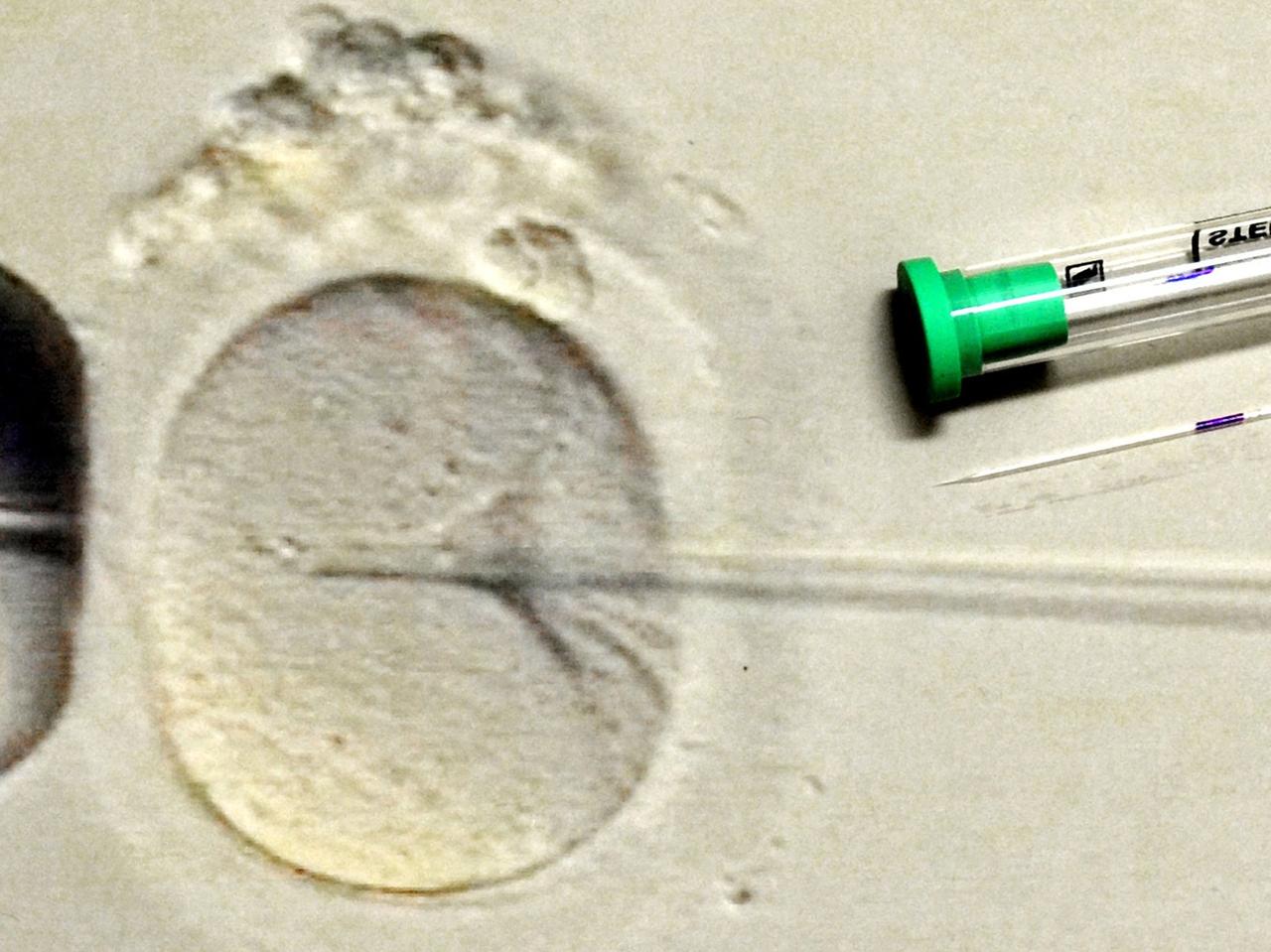 Im Biologischen Labor des Zentrums für Reproduktionsmedizin an der Universitätsfrauenklinik in Leipzig ist eine 200-fache Vergrößerungen der Befruchtung einer Eizelle zu sehen, aufgenommen am 17.03.2011.