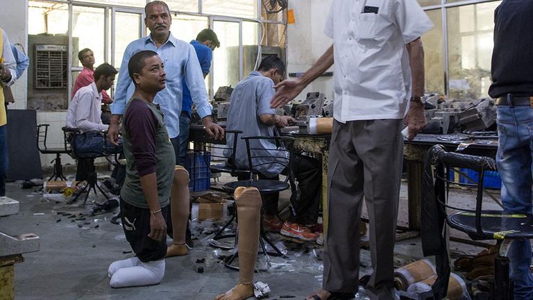Ein Patient mit amputierten Unterschenkeln ist bei Jaipur Foot zum Anpassen einer Prothese