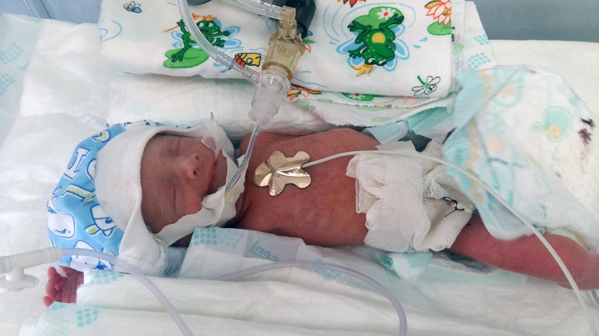 Ein Frühgeborenes im Krankenhaus in Bilowodsk in der Ostukraine