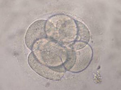 Mikroskopische Aufnahme einer Eizelle im Acht-Zellen-Stadium: Klon eines menschlichen Embryos