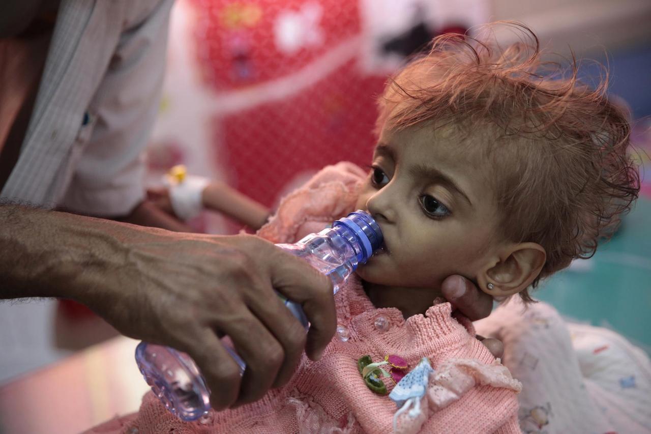 Ein Vater gibt seiner Tochter Wasser zu trinken in einem Hospital in Hodeida Ein Vater gibt seiner Tochter Wasser zu trinken in einem Hospital in Hodeida