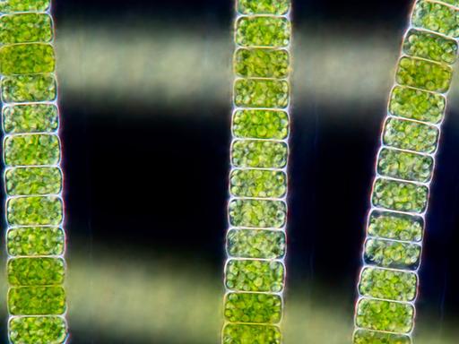 Mikroskopische Ansicht einer Alge.