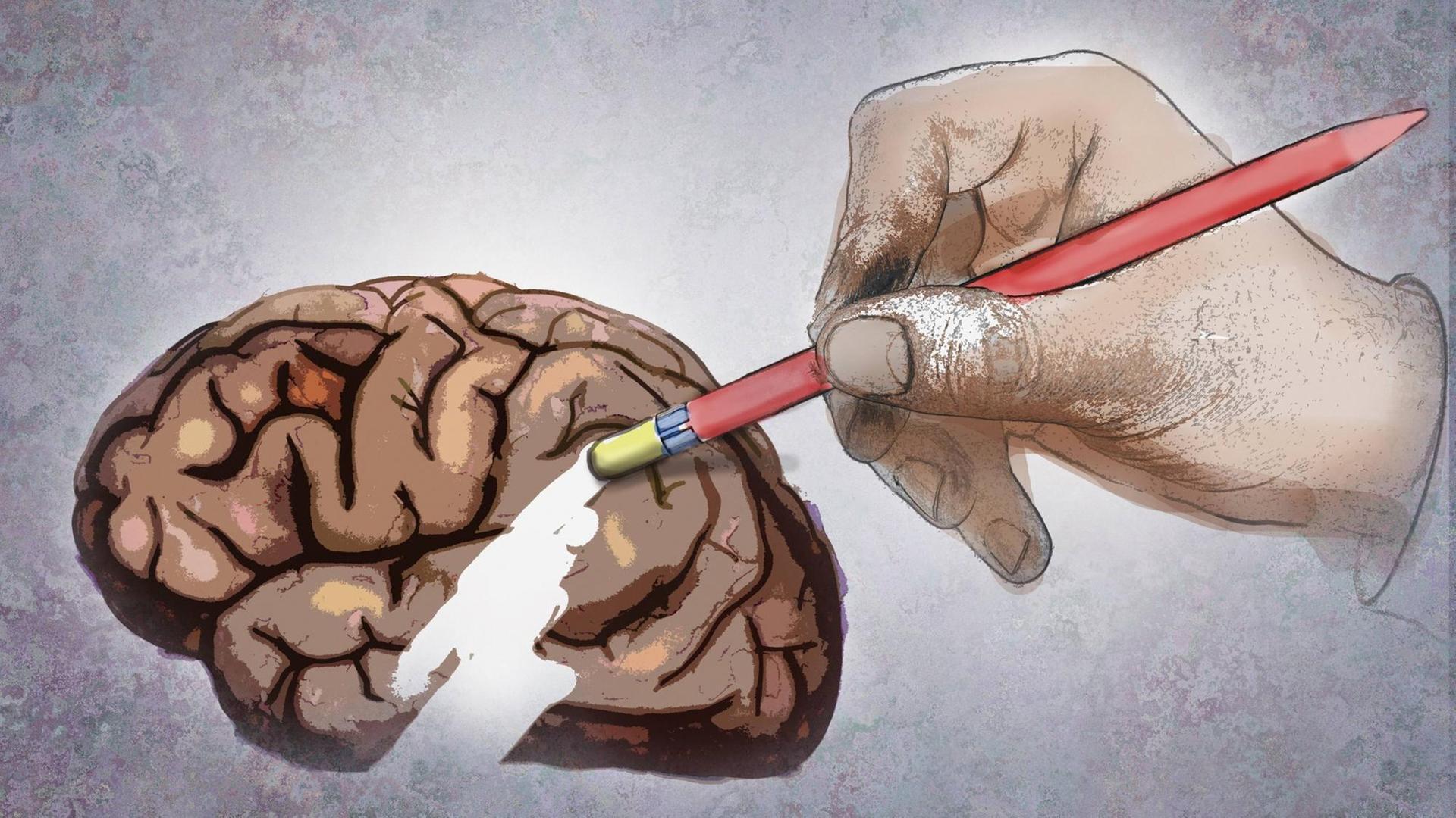 Illustration: eine große Hand löscht einen Teil des Gehirns mit einem Radiergummi am Ende eines Bleistifts. Illustration: eine große Hand löscht einen Teil des Gehirns mit einem Radiergummi am Ende eines Bleistifts.