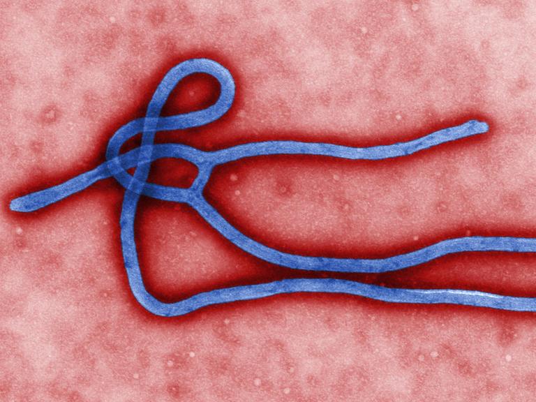 Eine farbige Darstellung von dem Ebola-Virus, wie es unter einem starken Elektronen-Mikroskop aussieht.