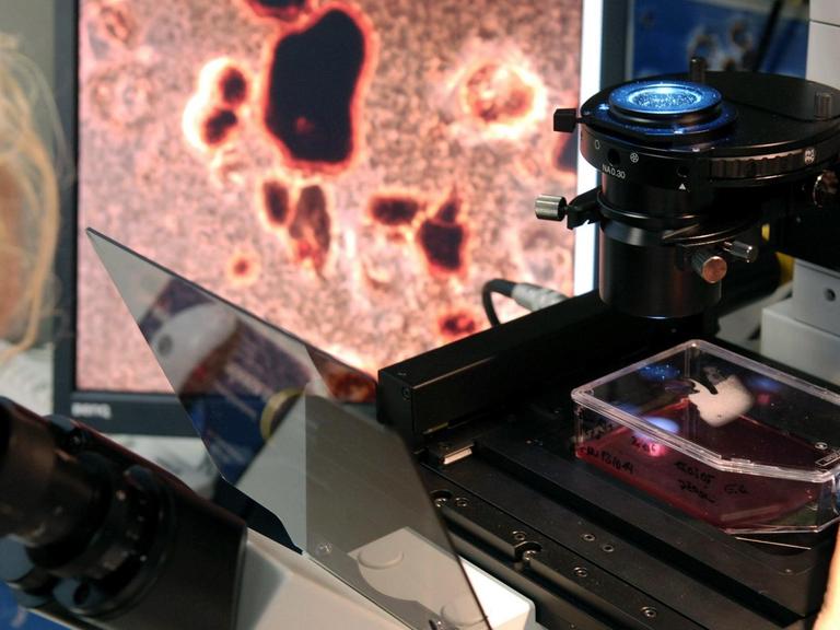 Durch ein Mikroskop ist der Anreicherungsprozess von Nanopartikeln in Krebszellen zu sehen.