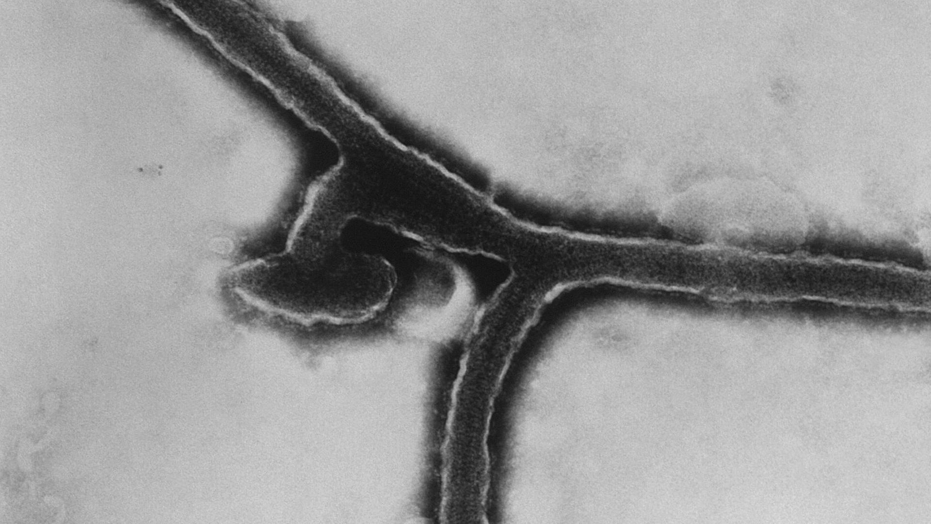 This transmission electron micrograph (TEM) revealed some of the ultrastructural morphology exhibited by the Marburg virus, the cause of Marburg hemorrhagic fever. Marburg hemorrhagic fever is a rare, severe type of hemorrhagic fever which affects both humans and non-human primates. This transmission electron micrograph (TEM) revealed some of the ultrastructural morphology exhibited by the Marburg virus, the cause of Marburg hemorrhagic fever. Marburg hemorrhagic fever is a rare, severe type of hemorrhagic fever which affects both humans and non-human primates.