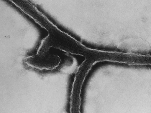 This transmission electron micrograph (TEM) revealed some of the ultrastructural morphology exhibited by the Marburg virus, the cause of Marburg hemorrhagic fever. Marburg hemorrhagic fever is a rare, severe type of hemorrhagic fever which affects both humans and non-human primates.