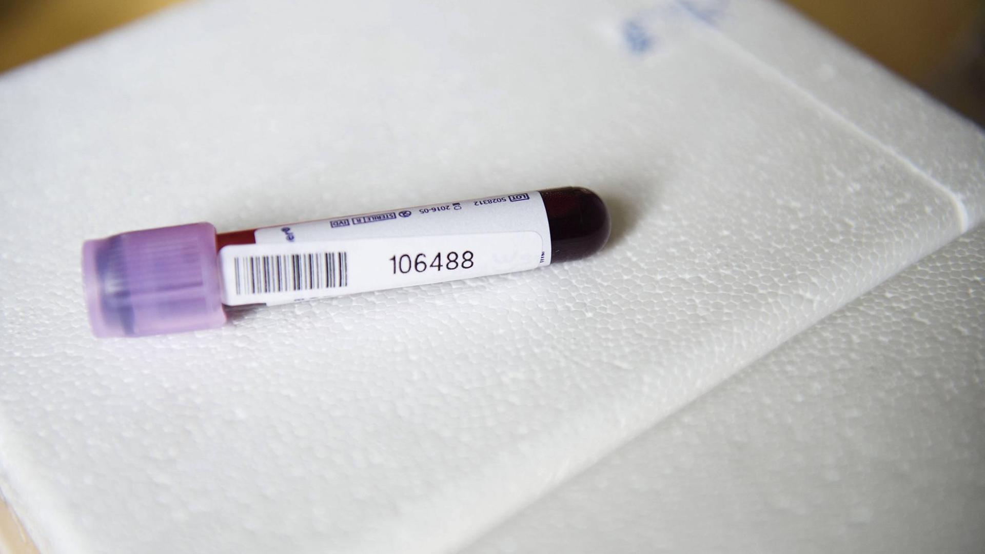Doping-Kontrolle des Schwedischen Fußball-Verbandes Doping-Kontrolle des Schwedischen Fußball-Verbandes