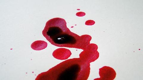 Wie bekommt man die krankmachenden Antikörper aus dem Blut?