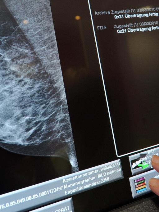 Eine Medizinisch-technische Radiologieassistentin (MTRA) überprüf in Hannover in dem Mammografie Screening Zentrum die Aufnahme einer Brust.