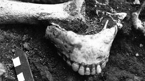 Unterkiefers eines Steinzeitmenschen, der im Sommer 1991 in Dmanisi, Südgeorgien, gefunden wurde. Die Entdeckung der etwa 1,8 Millionen Jahre alten Knochen galt als Sensation. Unterkiefers eines Steinzeitmenschen, der im Sommer 1991 in Dmanisi, Südgeorgien, gefunden wurde. Die Entdeckung der etwa 1,8 Millionen Jahre alten Knochen galt als Sensation.