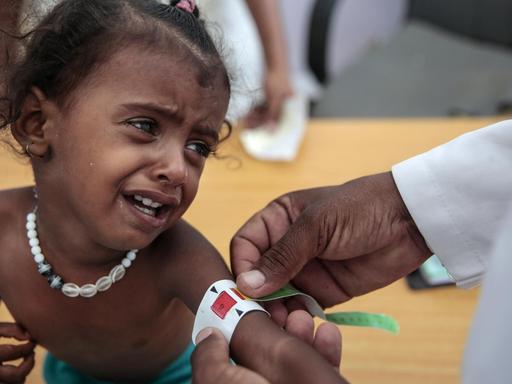 Ein Arzt misst den Arm eines unterernährten Mädchens im Aslam Health Center, Hajjah, Jemen.