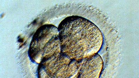 Menschlicher Embryo.