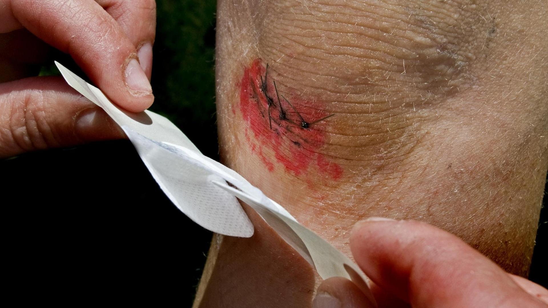 Ein Pflaster wird über eine Wunde am Knie geklebt Ein Pflaster wird über eine Wunde am Knie geklebt