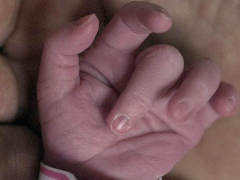 Zerbrechlichkeit trifft auf Behutsamkeit - das Händchen eines frühgeborenen Kindes.