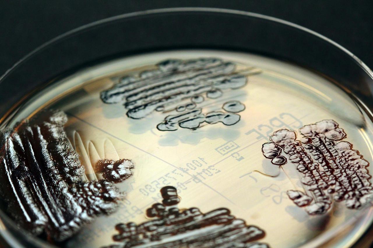 Multiresistente Enterobakterien - in einer Petrischale nachgewiesen. Multiresistente Enterobakterien - in einer Petrischale nachgewiesen.