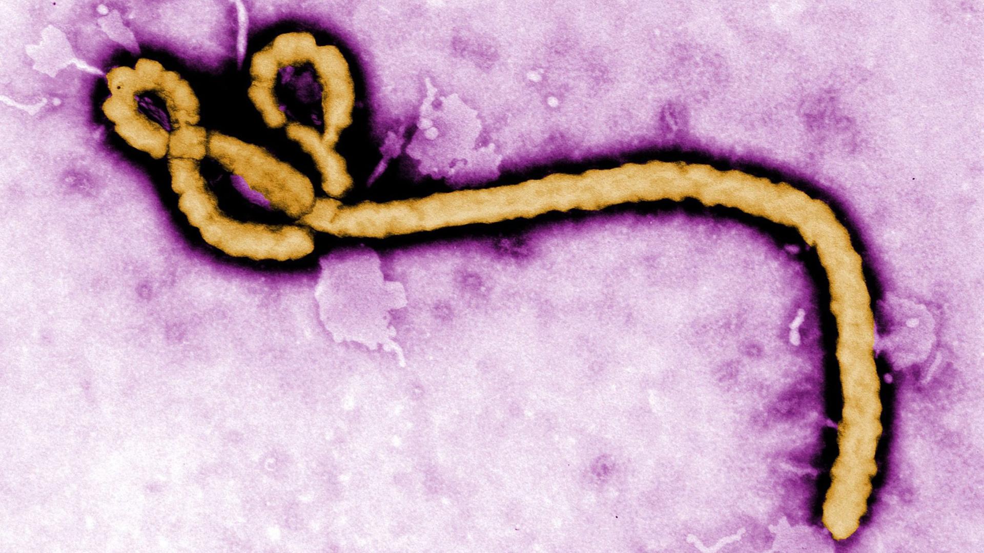 Mikroskop-Aufnahme des Ebola-Virus Mikroskop-Aufnahme des Ebola-Virus