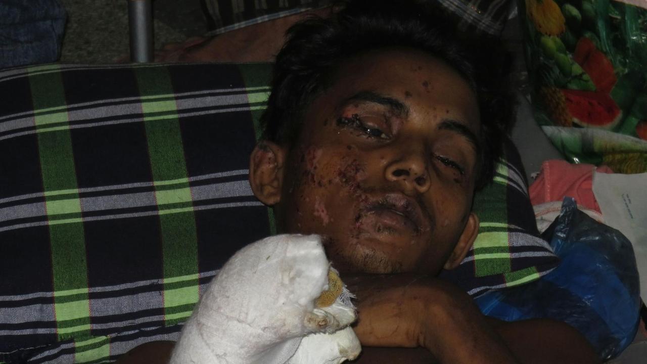 Der Rohingya Yusuf Nobi kann nichts mehr sehen, seine Füße wurden bei der Explosion zerfetzt. Er sagt, er sei an der Grenze von Myanmar zu Bangladesch auf eine Mine getreten. Oktober 2017