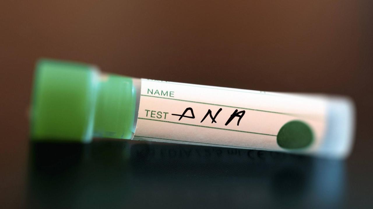 Röhrchen, auf dem "Test DNA" geschrieben steht(symbolbild)