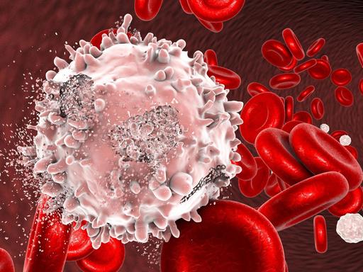 Illustration einer Blutkrebs-Zelle