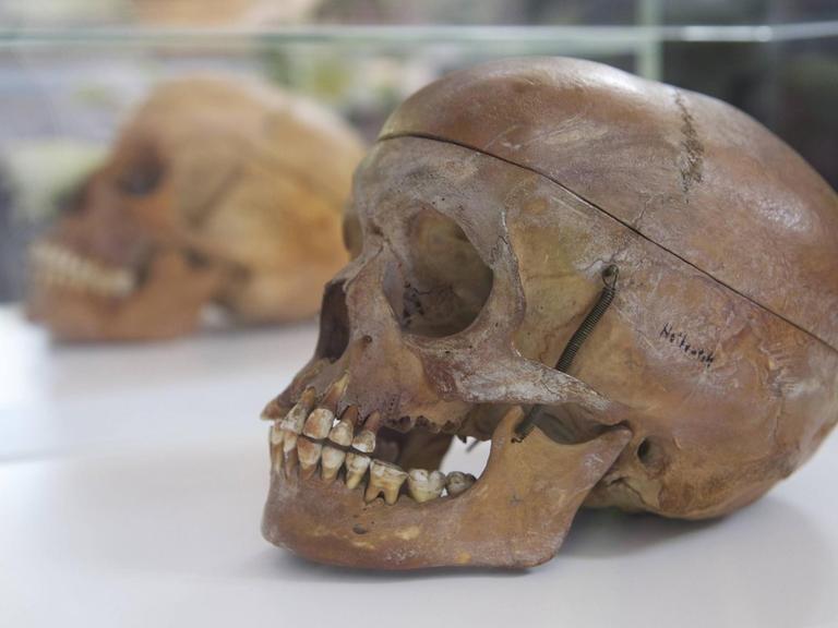 Schädel eines Opfers des Völkermords in Namibia