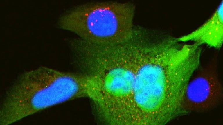 Mit einem rekombinanten Zytomegalievirus infizierte Zellen (Virusprotein: grün-fluoreszierend). Die Zellen sind, abhängig vom Stadium der Infektion, unterschiedlich stark grün gefärbt. Das zelluläre Protein NEMO wurde rot angefärbt. Mit einem rekombinanten Zytomegalievirus infizierte Zellen (Virusprotein: grün-fluoreszierend). Die Zellen sind, abhängig vom Stadium der Infektion, unterschiedlich stark grün gefärbt. Das zelluläre Protein NEMO wurde rot angefärbt.