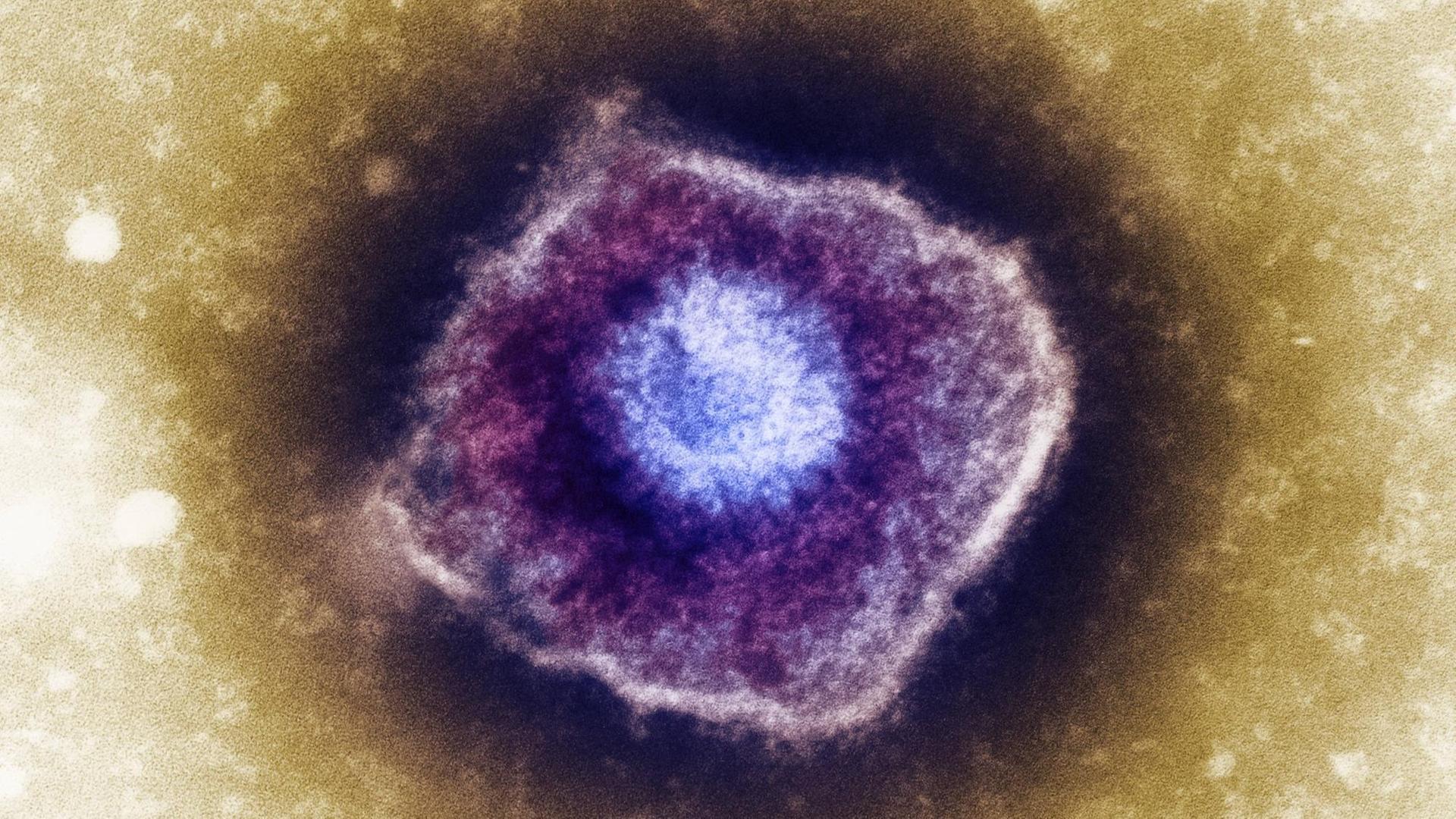 Varizella-Zoster Virus, das beim Menschen Windpocken und Gürtelrose hervorruft. Varizella-Zoster Virus, das beim Menschen Windpocken und Gürtelrose hervorruft.