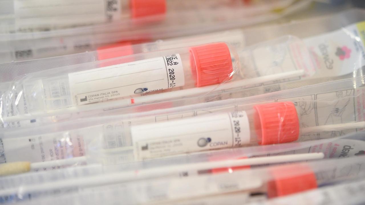Coronavirus-Teströhrchen in einer Ambulanz in Stuttgart Coronavirus-Teströhrchen in einer Ambulanz in Stuttgart