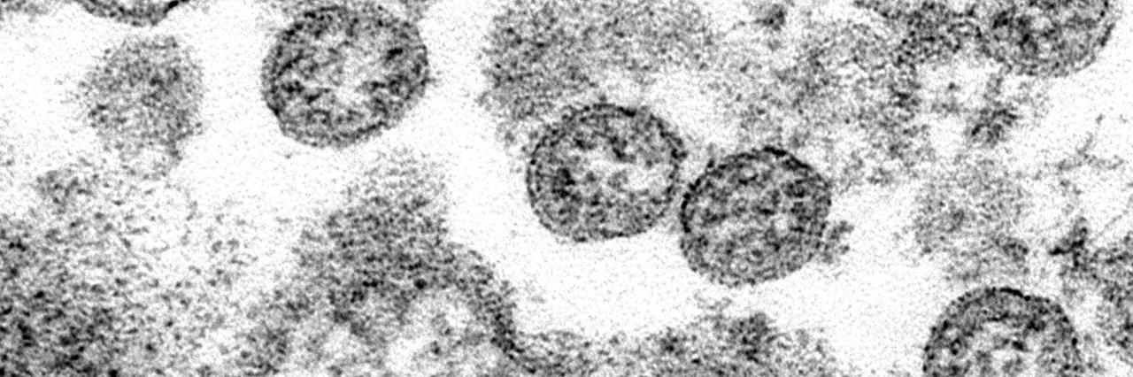 Das Bild zeigt kugelförmige Coronaviren, aufgenommen mit einem Elektronenmikroskop.