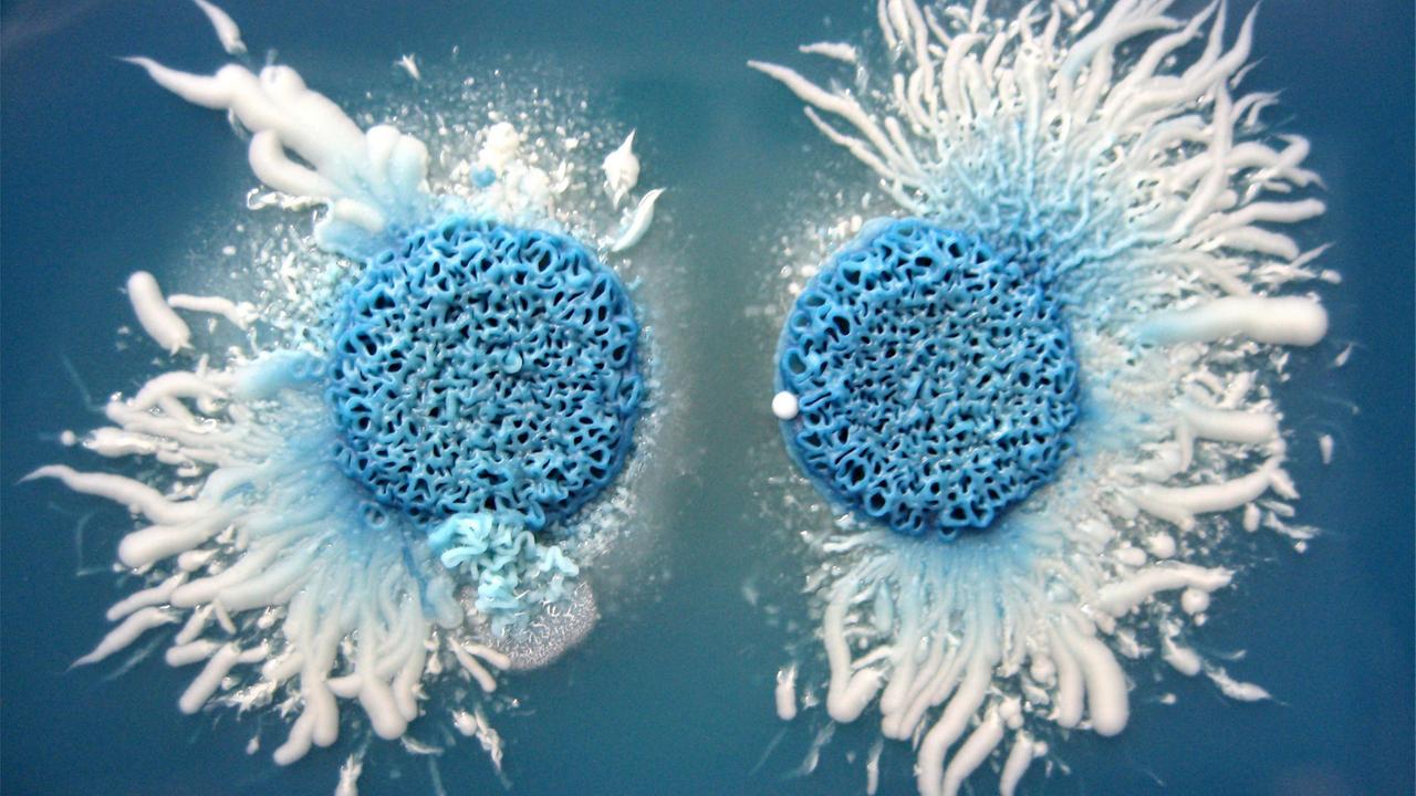 Schön, aber gefährlich: Zwei Kolonien des humanpathogenen Hefepilzes Candida albicans auf GM-Bromocresol-Agar, einem Spezialnährboden, der zu einer typischen Färbung der Zellen führt. Schön, aber gefährlich: Zwei Kolonien des humanpathogenen Hefepilzes Candida albicans auf GM-Bromocresol-Agar, einem Spezialnährboden, der zu einer typischen Färbung der Zellen führt.