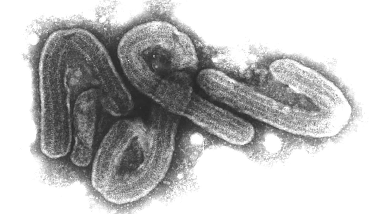 Eine elektronenmikroskopische Aufnahme des Marburg-Virus Eine elektronenmikroskopische Aufnahme des Marburg-Virus