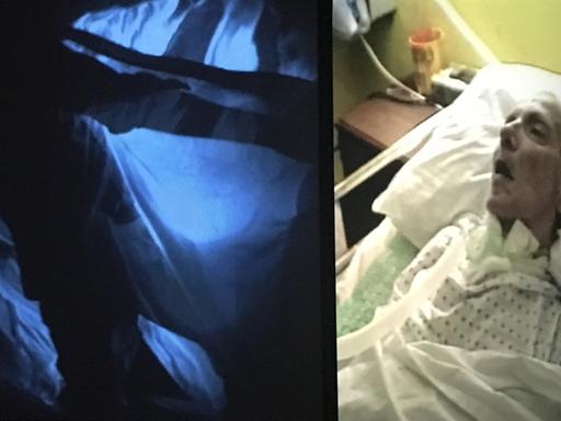 Das Bild zeigt eine Videoaufnahme einer alten, sterbenden Frau im Krankenhausbett