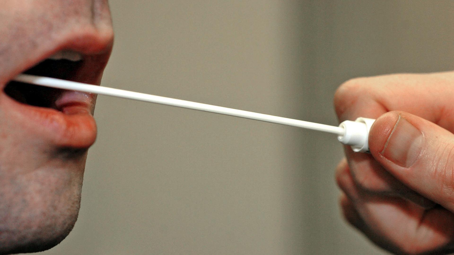 Für einen Vaterschaftstest werden Speichelproben entnommen. Für einen Vaterschaftstest werden Speichelproben entnommen.