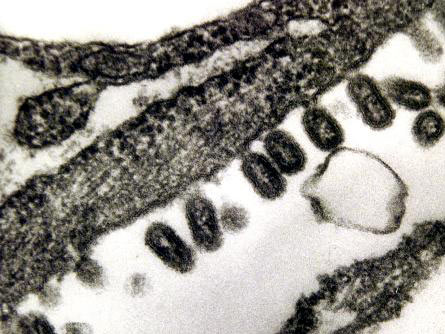 Grippevirus unter dem Mikroskop